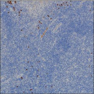 Anti-Human IgG2