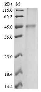 ATP-sensitive inward rectifier potassium channel 10 (KCNJ10), human, recombinant