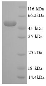 Large ribosomal subunit protein eL14 (RPL14), partial, human, recombinant