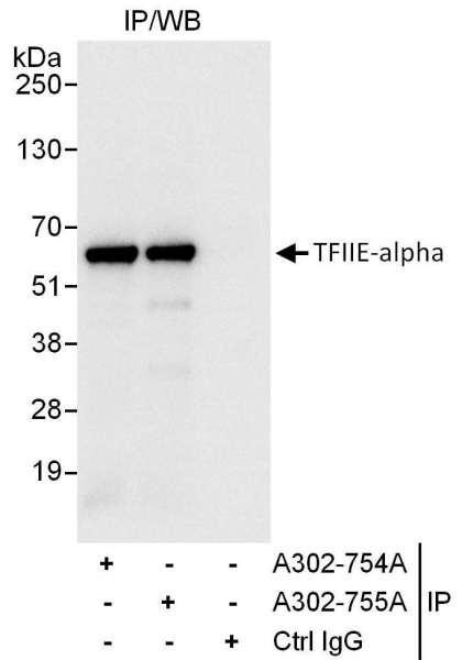 Anti-GTF2E1/TFIIE-alpha