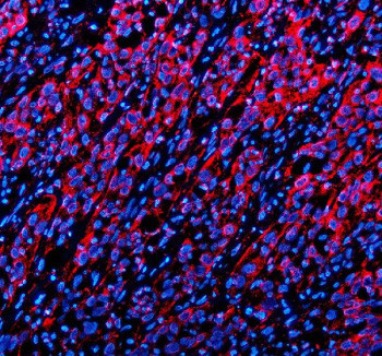 Anti-TWSG1 / Twisted gastrulation protein homolog 1