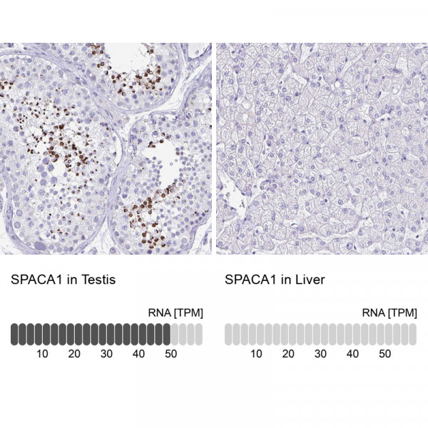 Anti-SPACA1