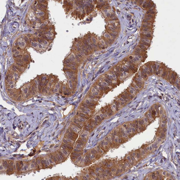 Anti-BICD1