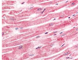 Anti-Sprouty-4 (Spry 4)