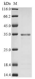 Non-receptor tyrosine-protein kinase TYK2 (TYK2), partial, human, recombinant
