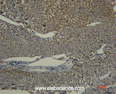 Anti-Transferrin, clone 5E5