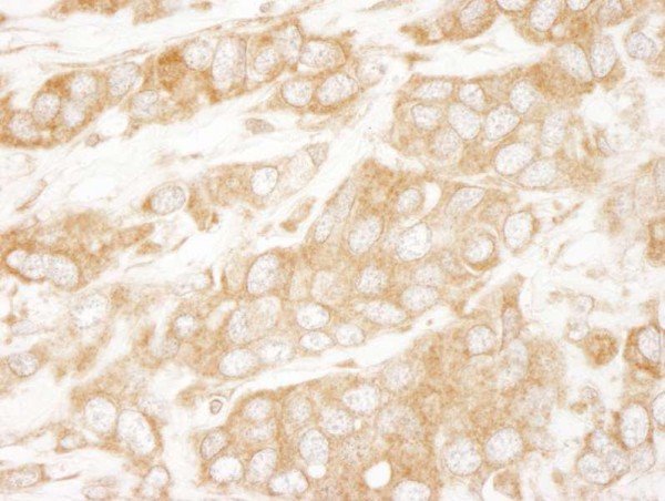 Anti-PTEN (IHC)