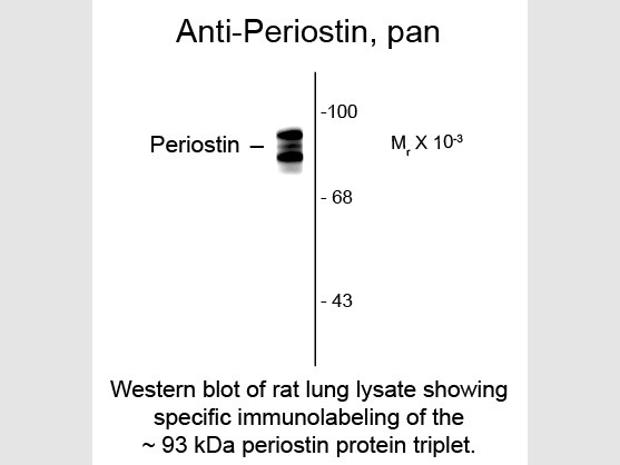Anti-Periostin