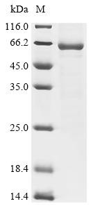 Matrix protein (M), recombinant human metapneumovirus