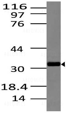 Anti-Dectin-2 (Clone: ABM2H28)