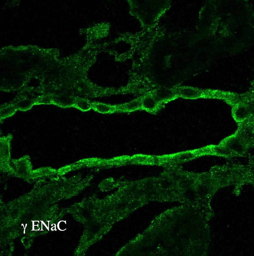 Anti-ENaC Gamma