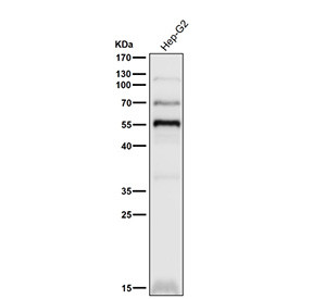 Anti-PPAR gamma / PPARG, clone 31P97