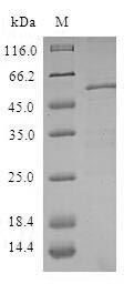ZW10 interactor (ZWINT), human, recombinant