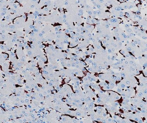 Anti-CD163, clone SQab19148