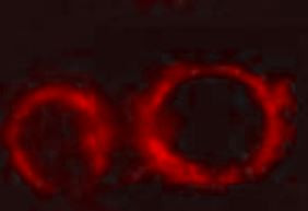 Anti-Pyruvate Dehydrogenase E2, clone 4A4-B6-C10