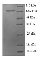 Probable histidine--tRNA ligase, mitochondrial (HARS2), human, recombinant