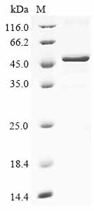 Kelch domain-containing protein 3 (KLHDC3), human, recombinant