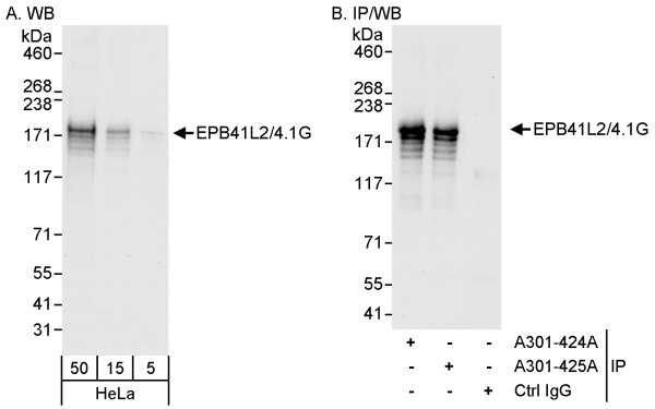 Anti-EPB41L2/4.1G