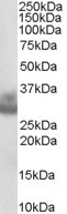 Anti-Cathepsin F, C-terminal