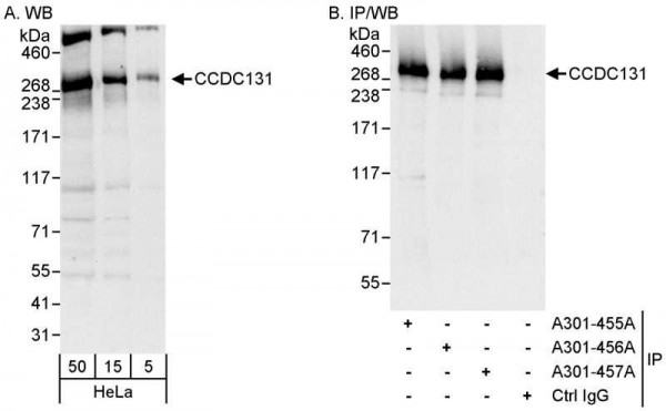 Anti-CCDC131