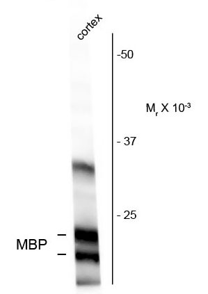 Anti-Myelin Basic Protein (MBP)