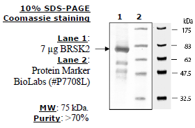 BRSK2, active human recombinant protein