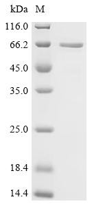 Phosphoprotein associated with glycosphingolipid-enriched microdomains 1(PAG1), partial, recombinant