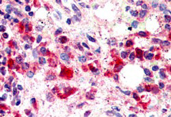 Anti-TREM2, C-terminal