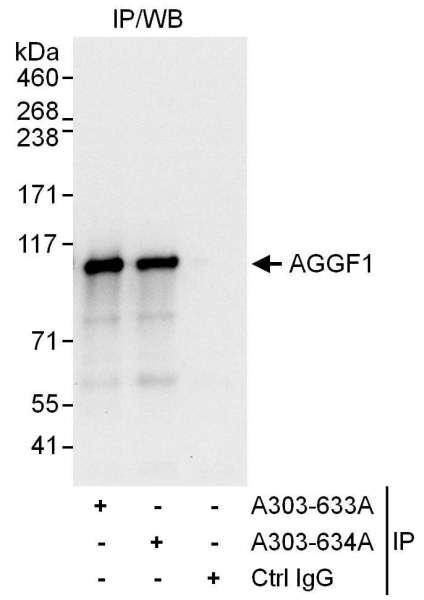 Anti-AGGF1