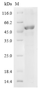 Ras-related protein Rab-35 (RAB35), human, recombinant