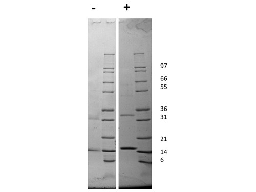 Granulocyte Macrophage-Colony Stimulating Factor