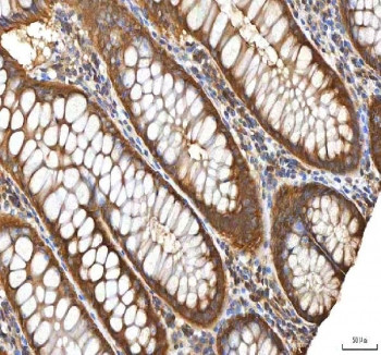 Anti-EIF3B / Eukaryotic translation initiation factor 3 subunit B