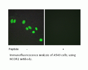 Anti-NCOR2