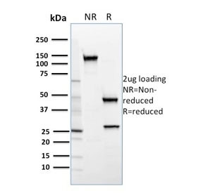 Anti-SREBP2 / SREBF2, clone SREBP2/1579