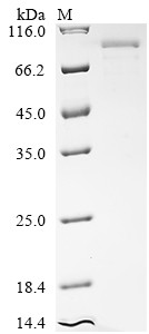 Major centromere autoantigen B (CENPB), human, recombinant