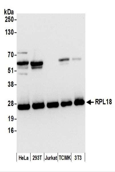 Anti-RPL18/Ribosomal Protein L18
