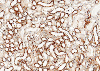 Anti-CLEC3B/Tetranectin Monoclonal Recombinant Antibody