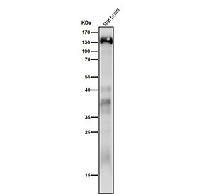 Anti-CTNND2 / Delta 2 Catenin, clone 31C89