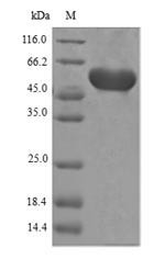 3-Phosphoshikimate 1-carboxyvinyltransferase (aroA), Agrobacterium sp., recombinant