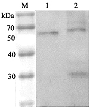 Anti-ANGPTL6 (human)