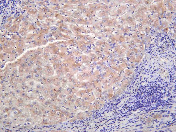 Anti-Recombinant Hepassocin, clone C312430