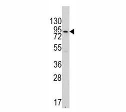 Anti-VE Cadherin (CDH5)