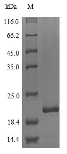 Myelin protein P0 (MPZ), partial, human, recombinant
