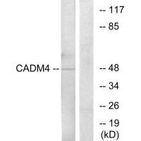 Anti-CADM4