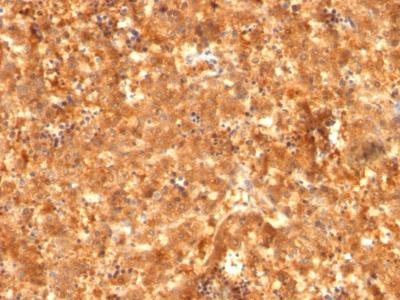 Anti-AFP (Alpha Fetoprotein) (Hepatocellular/Germ Cell Tumor Marker)(Clone: C2 + C3 + MBS-12)