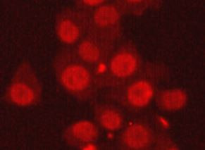 Anti-Ku70, clone 6H10-E9-G7