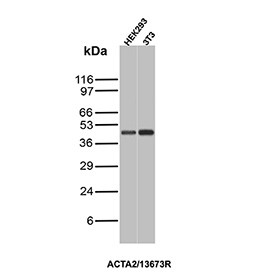 Anti-ACTA2 / Alpha Actin / Smooth Muscle Actin, clone ACTA2/13673R