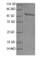 Tyrosine-protein kinase JAK2 (JAK2), partial, human, recombinant
