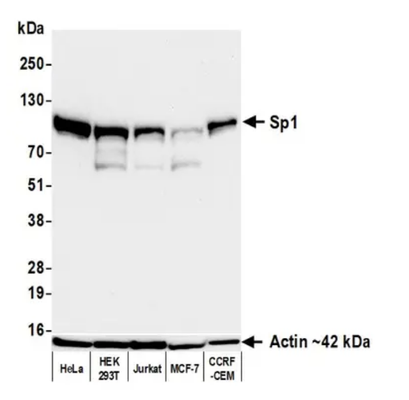 Anti-Sp1 Recombinant Monoclonal