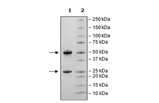 Anti-TL1A Neutralizing